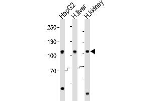 Western blot analysis of lysates from HepG2 cell line, human liver, human kidney tissue (from left to right), using MTTP Antibody (C-term) (ABIN6242904 and ABIN6577849). (MTTP 抗体  (C-Term))