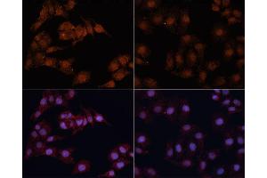 Immunofluorescence analysis of HeLa cells using MAP1LC3B antibody (ABIN6291773) at dilution of 1:100. (LC3B 抗体)