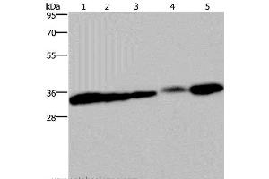 Western Blot analysis of HUVEC and 293T cell, Mouse bladder, Human placenta and Mouse kidney tissue using Claudin 23 Polyclonal Antibody at dilution of 1:200 (Claudin 23 抗体)