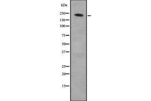 Western blot analysis of ARHGEF17 using K562 whole cell lysates (ARHGEF17 抗体  (C-Term))