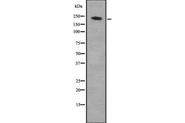 ARHGEF17 抗体  (C-Term)