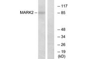 Western blot analysis of extracts from COS7 cells, using MARK2 Antibody. (MARK2 抗体  (AA 10-59))
