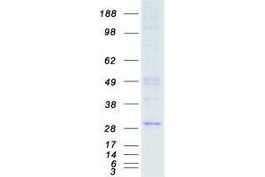 Western Blotting (WB) image for Eukaryotic Translation Initiation Factor 4E (EIF4E) (Transcript Variant 1) protein (Myc-DYKDDDDK Tag) (ABIN2720093)