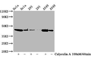 Western Blot Positive WB detected in Hela whole cell lysate,293 whole cell lysate,A549 whole cell lysate(treated with Calyculin A or not) All lanes Phospho-GSK3B antibody at 0. (Recombinant GSK3 beta 抗体  (pSer9))