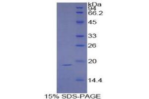 SDS-PAGE analysis of Human Sucrase Isomaltase Protein. (Sucrase Isomaltase 蛋白)