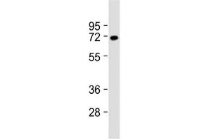Western blot testing of rat brain lysate with VGLUT2 antibody at 1:2000.