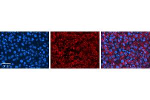 ASAHL antibody - middle region          Formalin Fixed Paraffin Embedded Tissue:  Human Liver Tissue    Observed Staining:  Cytoplasm in lysosomes of hepatocytes   Primary Antibody Concentration:  1:100    Other Working Concentrations:  1/600    Secondary Antibody:  Donkey anti-Rabbit-Cy3    Secondary Antibody Concentration:  1:200    Magnification:  20X    Exposure Time:  0. (NAAA 抗体  (Middle Region))
