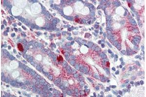 Human Small Intestine (formalin-fixed, paraffin-embedded) stained with MED4 antibody ABIN462248 followed by biotinylated goat anti-rabbit IgG secondary antibody ABIN481713, alkaline phosphatase-streptavidin and chromogen. (MED4 抗体  (AA 146-195))