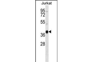 RCH4 Antibody (C-term) (ABIN657255 and ABIN2846352) western blot analysis in Jurkat cell line lysates (35 μg/lane). (MARCH4 抗体  (C-Term))