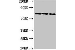 Western Blot Positive WB detected in: 293T whole cell lysate, Hela whole cell lysate, HepG2 whole cell lysate All lanes: NTN1 antibody at 6. (Netrin 1 抗体  (AA 186-478))