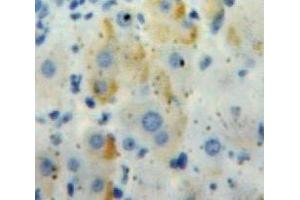 IHC-P analysis of Liver tissue, with DAB staining. (IL18RAP 抗体  (AA 117-240))