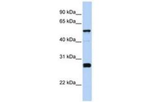 Image no. 1 for anti-Family with Sequence Similarity 83, Member F (FAM83F) (AA 288-337) antibody (ABIN6741146) (FAM83F 抗体  (AA 288-337))