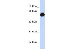 AKAP1 antibody used at 1 ug/ml to detect target protein. (AKAP1 抗体)