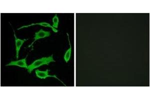 Immunofluorescence analysis of LOVO cells, using GPR85 Antibody. (GPR85 抗体  (AA 181-230))