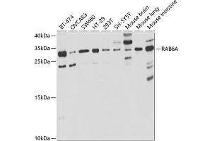 Western blot analysis of extracts of various cell lines, using RA antibody (ABIN6128604, ABIN6146602, ABIN6146604 and ABIN6221246) at 1:1000 dilution. (RAB6A 抗体  (AA 1-200))