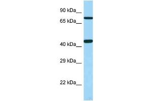 WB Suggested Anti-UTS2R Antibody Titration: 1. (UTS2R 抗体  (C-Term))