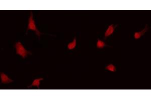 ABIN6268978 staining Hela by IF/ICC. (LCK 抗体  (pSer59))