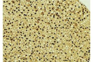 ABIN6277058 at 1/100 staining Mouse liver tissue by IHC-P. (TOR1A 抗体  (Internal Region))
