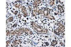 Immunohistochemical staining of paraffin-embedded breast tissue using anti-SHC1 mouse monoclonal antibody. (SHC1 抗体)