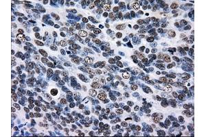 Immunohistochemical staining of paraffin-embedded Kidney tissue using anti-RPA2 mouse monoclonal antibody. (RPA2 抗体)