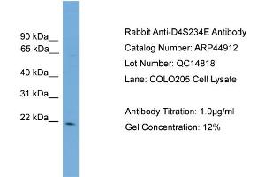 WB Suggested Anti-D4S234E  Antibody Titration: 0. (NSG1 抗体  (N-Term))