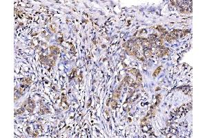 IHC analysis of MIRO1/RHOT1 using anti-MIRO1/RHOT1 antibody (ABIN7602209).