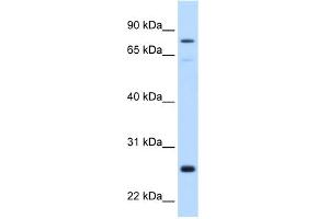 WB Suggested Anti-GSTM2 Antibody Titration:  0. (GSTM2 抗体  (N-Term))