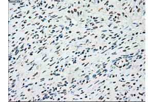 Immunohistochemical staining of paraffin-embedded colon tissue using anti-STK3mouse monoclonal antibody. (STK3 抗体)