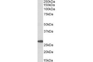 Western Blotting (WB) image for anti-Prostaglandin D2 Synthase (PTGDS) (Internal Region) antibody (ABIN5539880)