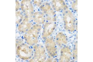 Immunohistochemistry of paraffin-embedded Rat kidney using C9orf114 Rabbit pAb (ABIN7266390) at dilution of 1:100 (40x lens). (C9orf114 抗体)