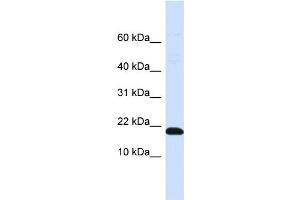 WB Suggested Anti-DNAJC25-GNG10 Antibody Titration:  0. (DNAJC25-GNG10 抗体  (N-Term))