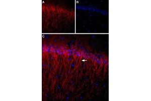 Expression of CACNB1 (CaVβ1) in rat hippocampus - Immunohistochemical staining of rat hippocampus using Anti-CACNB1 Antibody (ABIN7042984, ABIN7044049 and ABIN7044050). (CACNB1 抗体  (C-Term, Intracellular))