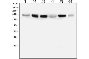 Western blot analysis of IRS1 using anti-IRS1 antibody (ABIN7599659).