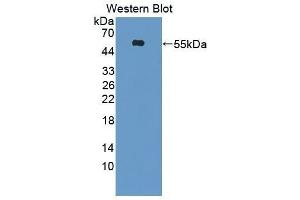 Western Blotting (WB) image for anti-Hepatitis A Virus Cellular Receptor 1 (HAVCR1) (AA 21-245) antibody (ABIN1859535) (HAVCR1 抗体  (AA 21-245))