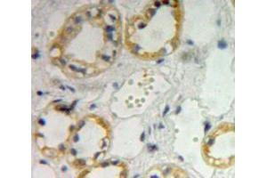 IHC-P analysis of kidney tissue, with DAB staining. (IL4 Receptor 抗体  (AA 26-233))