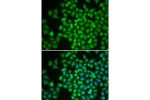 Immunofluorescence (IF) image for anti-COP9 Constitutive Photomorphogenic Homolog Subunit 5 (Arabidopsis) (COPS5) (AA 1-334) antibody (ABIN6218868) (COPS5 抗体  (AA 1-334))