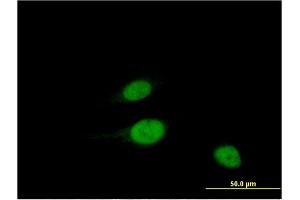 Immunofluorescence of monoclonal antibody to WBSCR22 on HeLa cell. (WBSCR22 抗体  (AA 1-110))