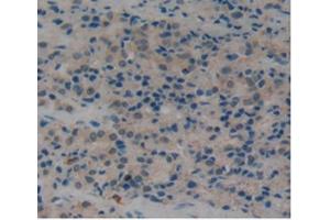 Immunohistochemistry (IHC) image for anti-Plasminogen Activator, Tissue (PLAT) (AA 311-562) antibody (ABIN1860843)