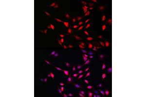 Immunofluorescence analysis of NIH/3T3 cells using UFM1 Rabbit pAb (ABIN7271184) at dilution of 1:150 (40x lens). (UFM1 抗体  (AA 1-85))