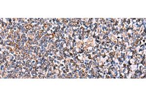 Immunohistochemistry of paraffin-embedded Human tonsil tissue using INSC Polyclonal Antibody at dilution of 1:65(x200) (INSC 抗体)