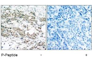 Image no. 1 for anti-Forkhead Box O4 (FOXO4) (pSer197) antibody (ABIN196850) (FOXO4 抗体  (pSer197))