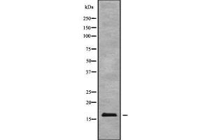 Western blot analysis of BTF3L4 using HT29 whole cell lysates (BTF3L4 抗体  (Internal Region))