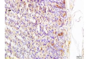 Formalin-fixed and paraffin embedded rat stomach tissue labeled with Anti-Somatostatin/GRIH Polyclonal Antibody, Unconjugated at 1:200 followed by conjugation to the secondary antibody and DAB staining (Somatostatin 抗体  (AA 103-116))