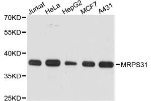 Western blot analysis of extracts of various cell lines, using MRPS31 antibody. (MRPS31 抗体)