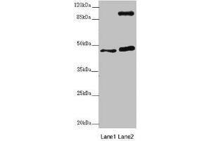 Western blot All lanes: AURKA antibody at 2 μg/mL Lane 1: NIH/3T3 whole cell lysate Lane 2: HT29 whole cell lysate Secondary Goat polyclonal to rabbit IgG at 1/10000 dilution Predicted band size: 46 kDa Observed band size: 46, 110 kDa