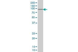 SOX13 monoclonal antibody (M01), clone 3E8 Western Blot analysis of SOX13 expression in Jurkat . (SOX13 抗体  (AA 25-138))