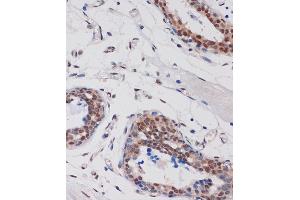 Immunohistochemistry (IHC) image for anti-AT Rich Interactive Domain 1B (SWI1-Like) (ARID1B) (AA 400-650) antibody (ABIN7265702)
