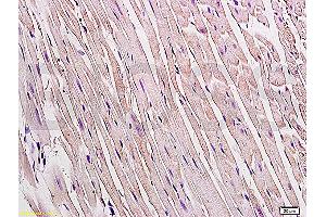 Formalin-fixed and paraffin embedded rat heart tissue labeled Anti-Connexin 43 Polyclonal Antibody, Unconjugated (ABIN671451) at 1:200, followed by conjugation to the secondary antibody and DAB staining