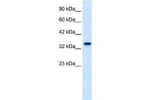 WB Suggested Anti-ZNF2 Antibody Titration:  1. (ZNF2 抗体  (N-Term))