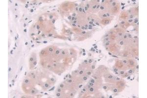 Detection of NQO1 in Human Stomach Tissue using Polyclonal Antibody to NADH Dehydrogenase, Quinone 1 (NQO1)